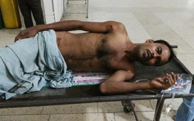 রাজধানীতে পুলিশের গুলিতে রিকশাচালক আহত