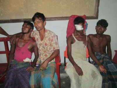 জলদস্যুর গুলিতে গুলিতে গুরুতর আহত জেলেরা