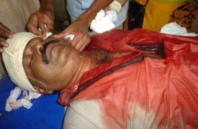 আহত উপজেলা চেয়ারম্যান আব্দুল হক