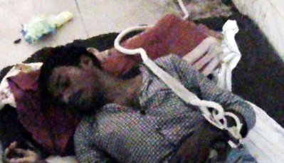 হাসপাতালের বিছানায় কোমড়ে রশি ও হাতে হাতকড়াসহ চিকিৎসাধীন বিমল কিসকো