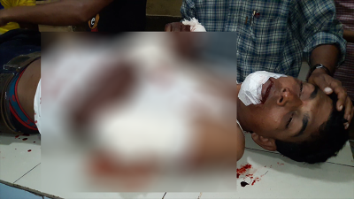 গুরুতর আহত এক শ্রমিক