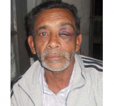 আহত মুক্তিযোদ্ধা অসিত কুমার সাহা