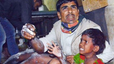 পেট্রোল বোমায় দগ্ধ শিশু কন্যাসহ পিতা