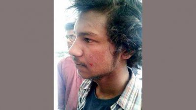 আহত ছাত্র ইউনিয়ন নেতা রাজীব দাস