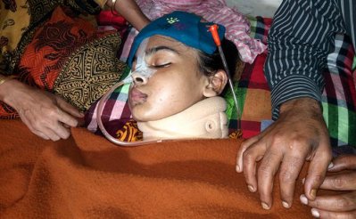 যৌতুকের দাবিতে নির্যাতিত হাবিবা মৃত্যুর সঙ্গে পাঞ্জা লড়ছেন