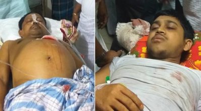 ঢামেকে চিকিৎসাধীন (বাঁ থেকে) সামছুল হক ও আলামিন