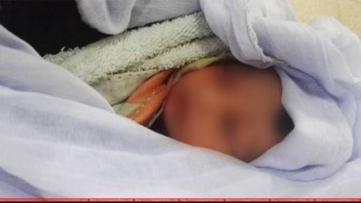 ডাস্টবিন থেকে উদ্ধার হওয়া নবজাতক