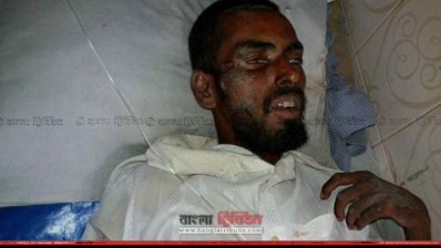 দশ দিন আগে হিলি থেকে অচেতন অবস্থায় উদ্ধার করা অজ্ঞাত ব্যক্তি। ছবি-প্রতিনিধি