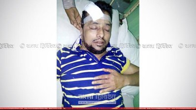 আহত নুর নবী বাবুল 