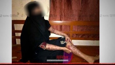 গৃহবধূর সারাশরীরে নির্যাতনের চিহ্ন