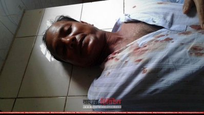 গুরুতর আহত একজন (ছবি- প্রতিনিধি)