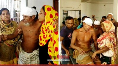 মাদারীপুর সদর হাসপাতালে চিকিৎসাধীন আহতরা