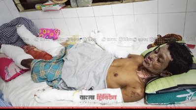 চমেক হাসপাতালে চিকিৎসাধীন রোহিঙ্গা তরুণ