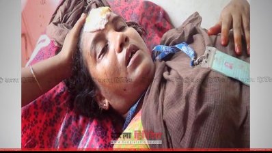 আহত এক শ্রমিক