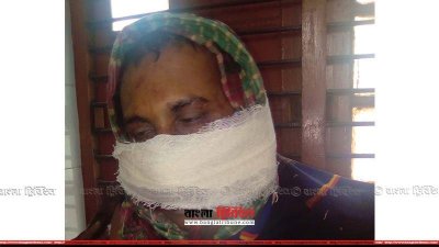 আহত শিক্ষক দেলোয়ার হোসেন খাঁন সনেট 