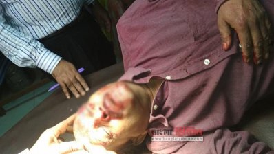 আহত বিশ্ববিদ্যালয়ের শিক্ষক হাছানুজ্জামান 