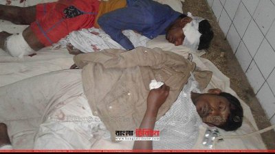 হাসপাতালে ভর্তি গুলিবিদ্ধ দুই ডাকাত