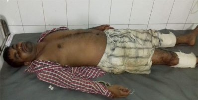 রাজধানীতে গত বছরের জুনে পুলিশের গুলিতে আহত হয় এক ছিনতাইকারী (ফাইল ছবি)
