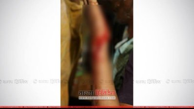 জন্মদিন পালন করায় ৯ ছাত্রকে রড দিয়ে পেটালেন শিক্ষক