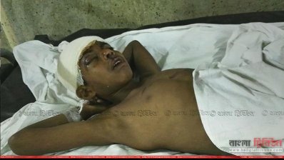 ঢামেকে আহত সালাউদ্দিন