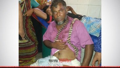 সংঘর্ষের ঘটনায় আহত এক ব্যক্তি