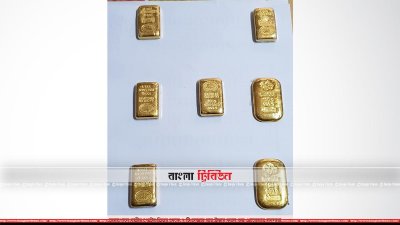 পেটের ভেতর থেকে উদ্ধার করা স্বর্ণ