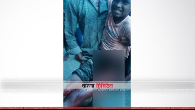 গুলিবিদ্ধ রোহিঙ্গা শিশু আনসার হোসেন (ছবি- প্রতিনিধি)