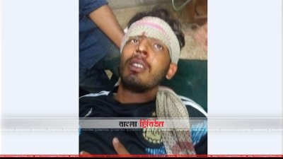 সংঘর্ষে আহত একজন