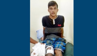 ভুল চিকিৎসায় পা হারাতে বসা সোহাগ 
