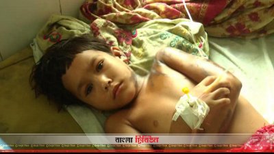 বড় বোন তানজিমের সঙ্গে এক বিছানায় শুয়ে এসিড দগ্ধ হয় শিশু মারজিয়াও। ছবি ঘটনার পরদিন ভোলার উপজেলা স্বাস্থ্য কমপ্লেক্সের।