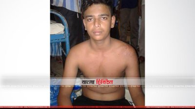 এসিড নিক্ষেপের শিকার ছাত্র মহিউদ্দীন