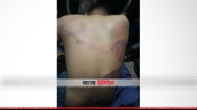 হামলায় আহত প্রথম আলোর নিজস্ব প্রতিবেদক আহমেদ দীপ্ত