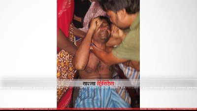 বিলাপ করছেন হারুন উর রশিদ (ছবি- প্রতিনিধি)