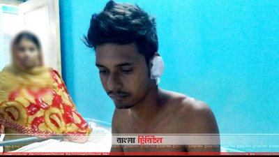 গাছের ডাল কাটাকে কেন্দ্র করে ঝগড়া, দেখতে গিয়ে যুবক গুলিবিদ্ধ