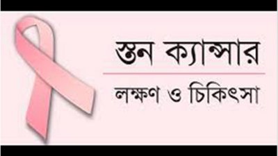 লালমাটিয়ায় স্তন ক্যান্সার স্ক্রিনিং সেন্টার চালু