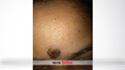 স্বামীর অবর্ণনীয় অত্যাচারের শিকার গৃহবধূ রহিমা আক্তার