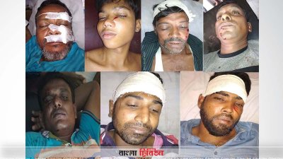 আ.লীগের দুগ্রুপের সংঘর্ষে আহত কয়েখ জন