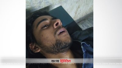 আহত সাংবাদিক রাব্বি হাসান সবুজ