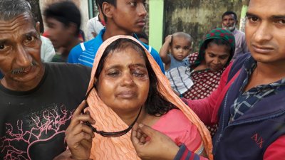 চোখে আঘাতপ্রাপ্ত গৃহবধূ নাজমা বেগম