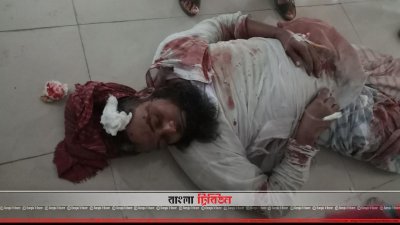 হাসপাতালে চিকিৎসাধীন মুসল্লিরা