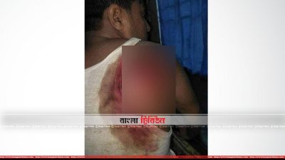আহত বিএনপি কর্মী