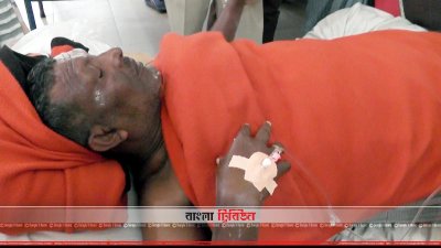 সিলিন্ডারের আগুনে দগ্ধ