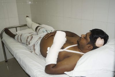 আহত আনোয়ার হোসেন