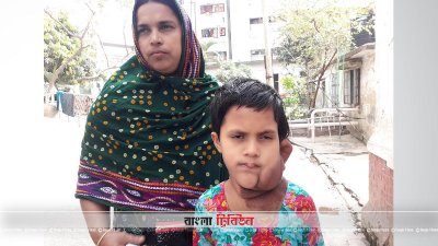 প্লেক্সিফর্ম নিউরোফাইব্রোমা রোগে আক্রান্ত যুথী