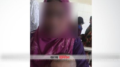 নির্যাতনের শিকার গৃহবধূর মুখের এক সাইট ক্ষতিগ্রস্ত হয়েছে 