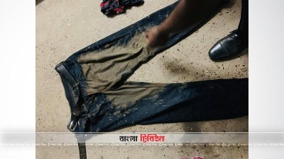 এডিস হামলার পর পারভেজ সানজারির প্যান্ট