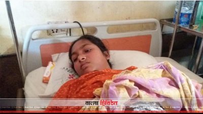 স্বামীর দেওয়া আগুনে দগ্ধ গৃহবধূ