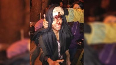 ফের রক্তাক্ত জেএনইউ, অভিযোগ আরএসএস-এর বিরুদ্ধে