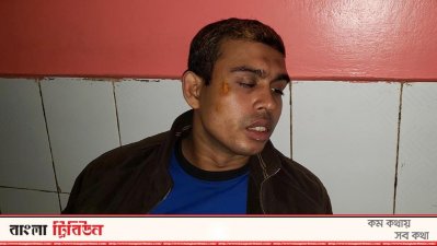 আহত পিবিআই কর্মকর্তা