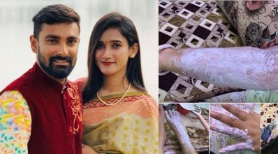 সিলিন্ডার বিস্ফোরণ থেকে বাঁচলেন লিটনপত্নী!